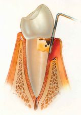 Пародонтология