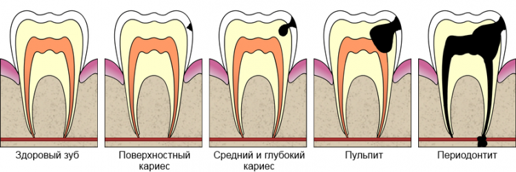 Зубы в Химках - лечение